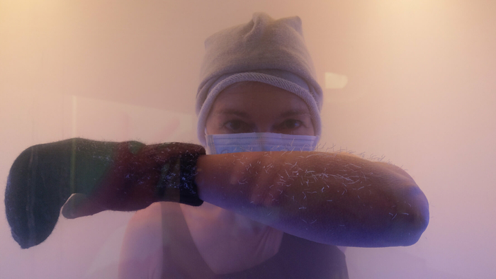 Kälteanwendung Kälteanwendung…